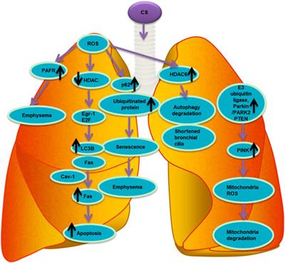 The interplay between oxidative stress and autophagy in chronic obstructive pulmonary disease